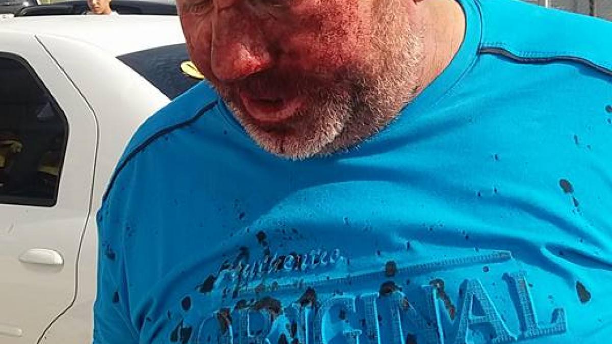 un antrenor din liga a iv a giurgiu a fost umplut de sange de rudele unui fotbalist imagini socante