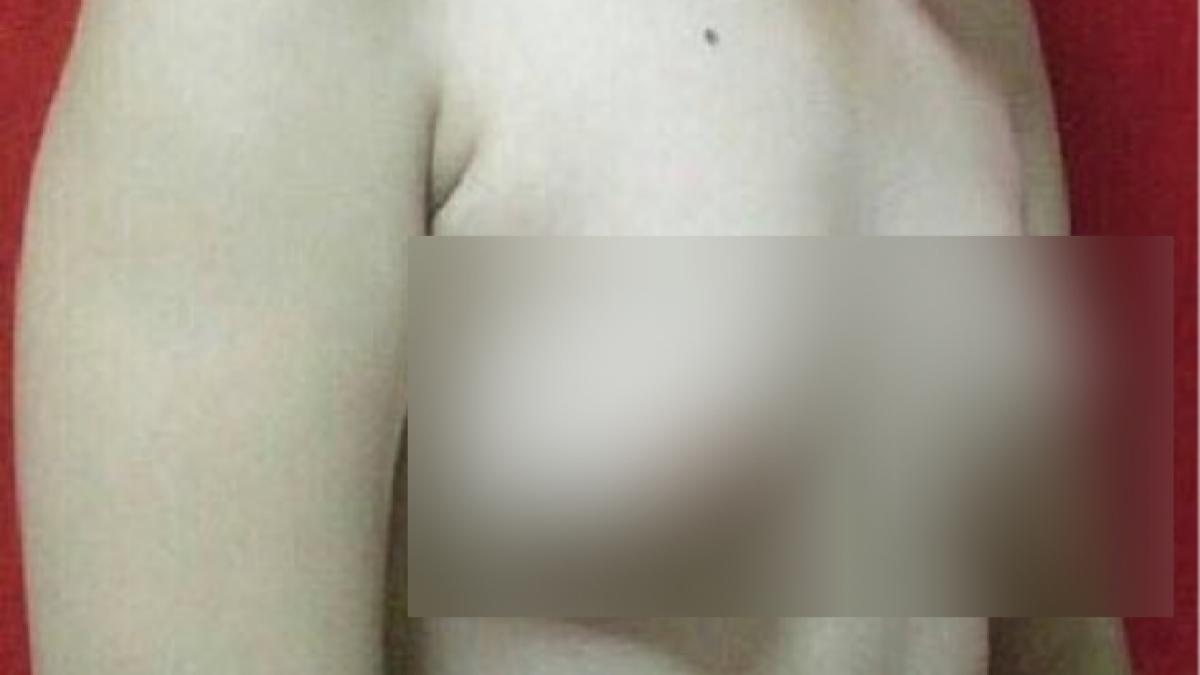 un barbat a descoperit ca ii cresc sanii dupa ce a mancat asta