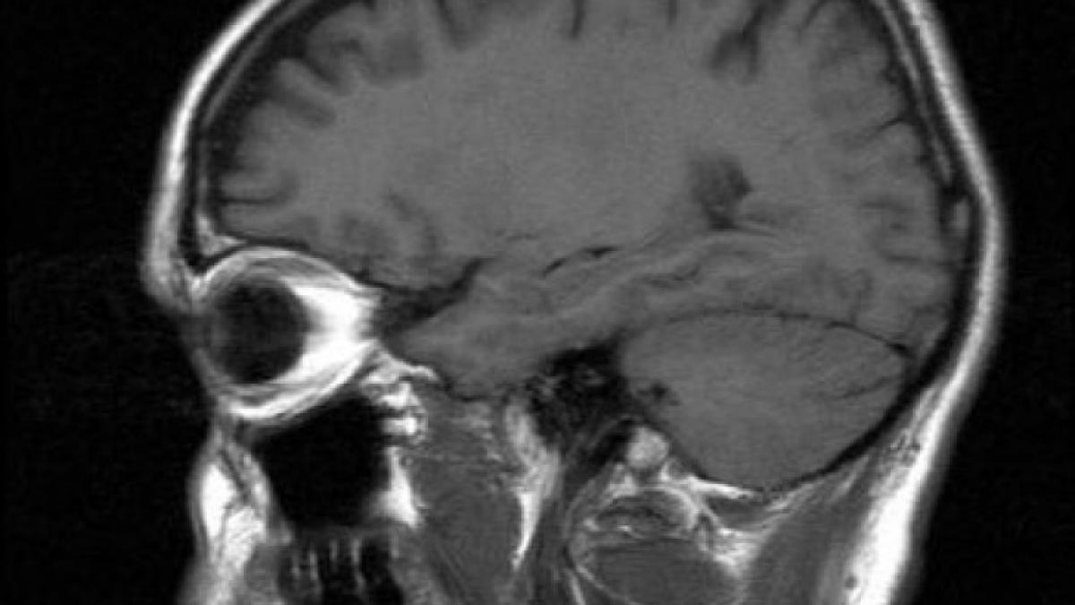 descoperire tulburatoare facuta de medici in radiografia unei tinere tu nu ar trebui sa fii in
