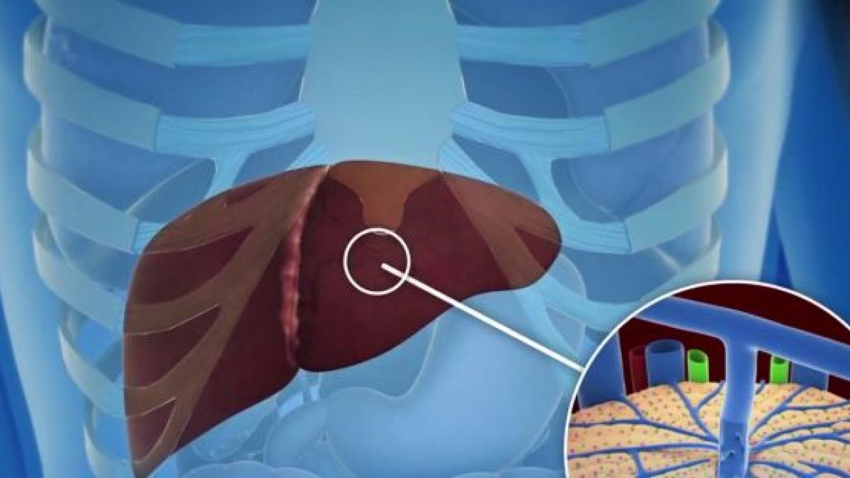 uniunea europeana vrea sa elimine virusul hepatitei c pana in 2030 ce masuri va lua romania