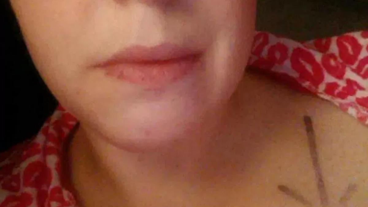 i s a spus ca are cancer a intrat imediat in sala de operatie dar cand i au scos tumora medicii au