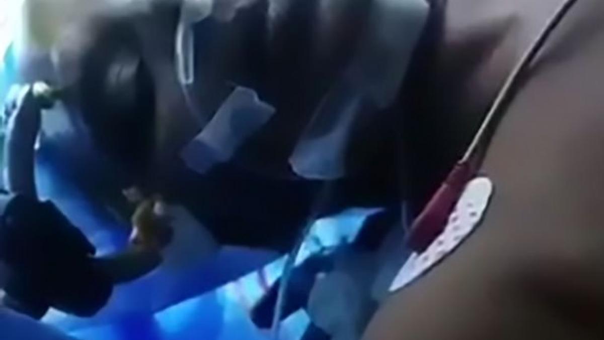 in timp ce era operata pe creier femeia s a uitat la un film ce a urmat i a lasat pe medici fara