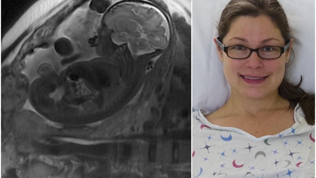 a nascut un baietel de nota 10 dar cand i au vazut placenta medicii au inceput sa tremure ce ii