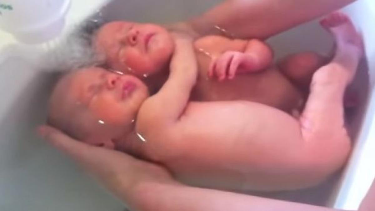 imaginile care au induiosat mii de inimi gemenii care se tin in brate si nu realizeaza ca s au