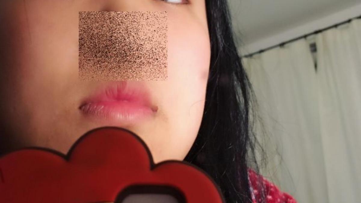 mergea pe strada si toti se uitau la nasul ei ce isi facuse fata asta pentru a arata mai bine