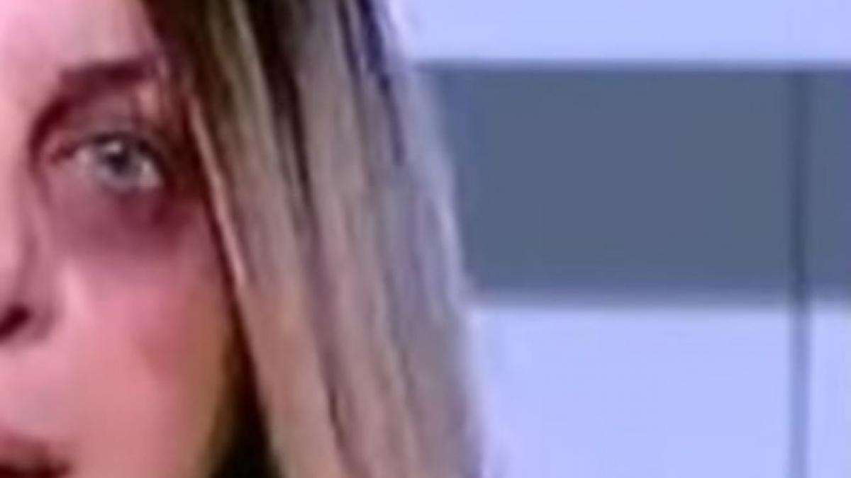 o cunoscuta prezentatoare a aparut cu vanatai pe fata la tv ce a dezvaluit vedeta la finalul