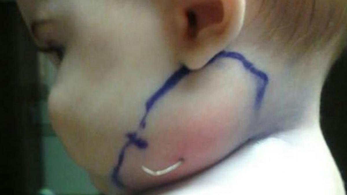 au observat ca fiicei lor ii iesea ceva straniu din obraz au apasat sa vada ce este si au inlemnit