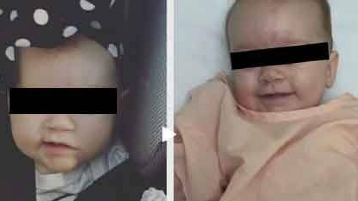 parintii au observat ceva ciudat cu fetita lor asa ca au dus o la spital medicii le au dat o veste