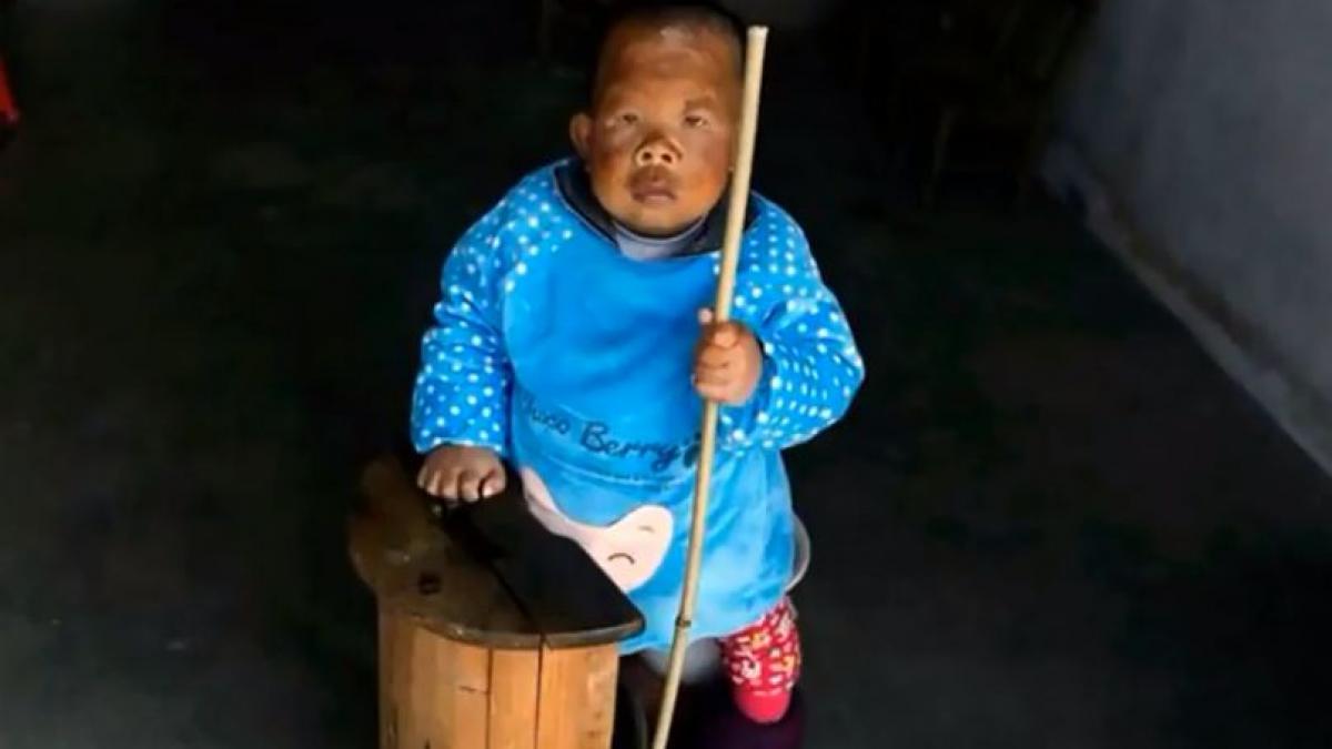 povestea barbatului de 30 de ani care arata ca un bebelus