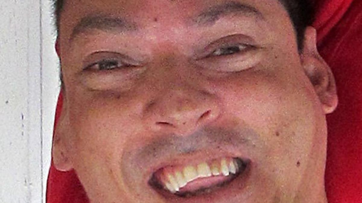 s a nascut cu capul intors pe spate iar medicii i au spus mamei sa nu il mai hraneasca si sa il