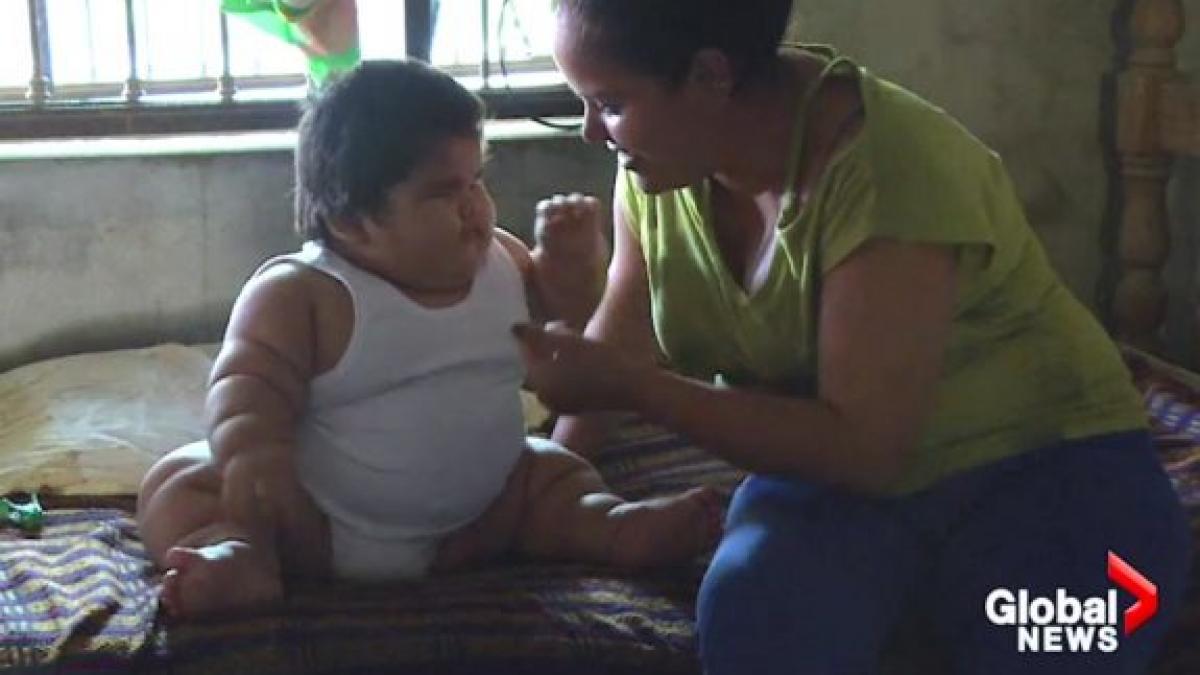 la zece luni un bebelus cantareste 28 de kilograme explicatia medicilor este de a dreptul socanta