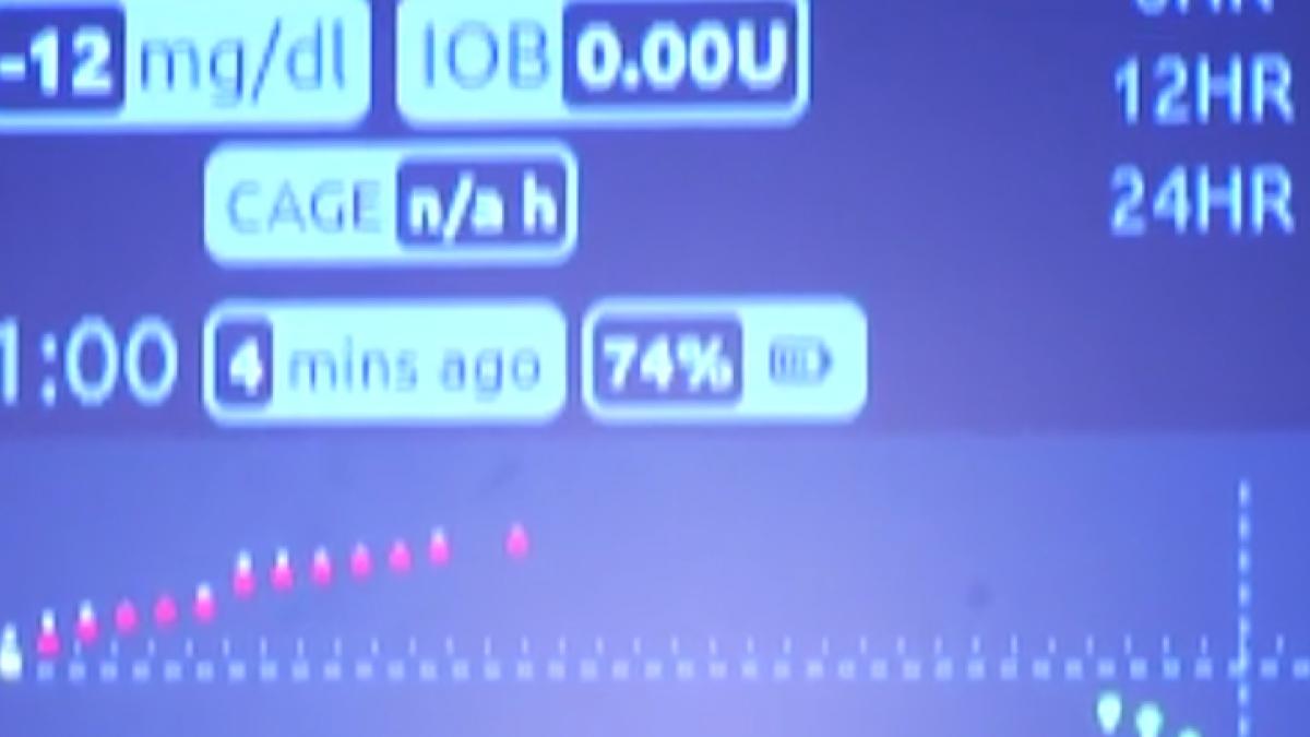 24 it senzorul care schimba viata diabeticilor