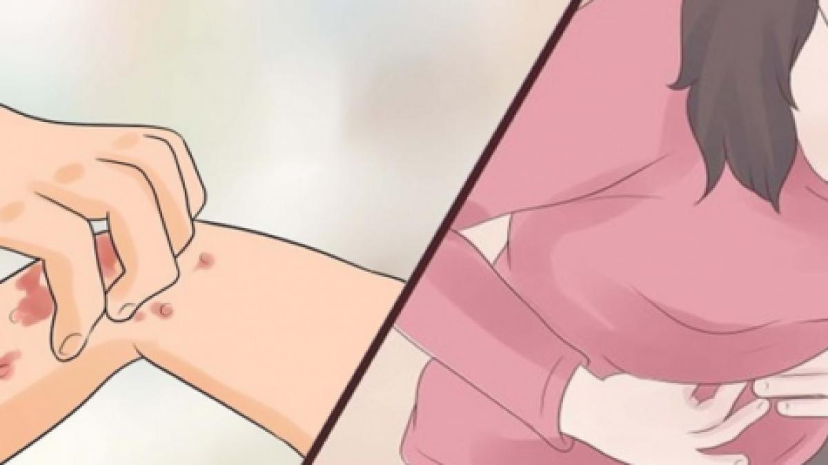 zece semne ca ai corpul plin de paraziti nu le mai ignora niciodata