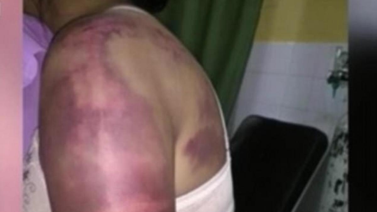 de fiecare data cand primea un like pe facebook sotul o batea povestea tinerei care a trebuit sa