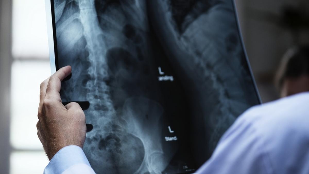 incredibil o familie de italieni este incapabila sa simta orice fel de durere explicatia uluitoare