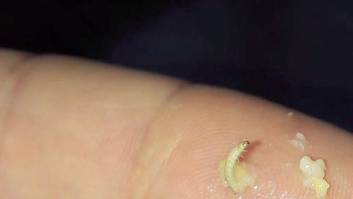 peste stricat si mamaliga cu viermi mancarea servita la spitalul de boli infectioase constanta