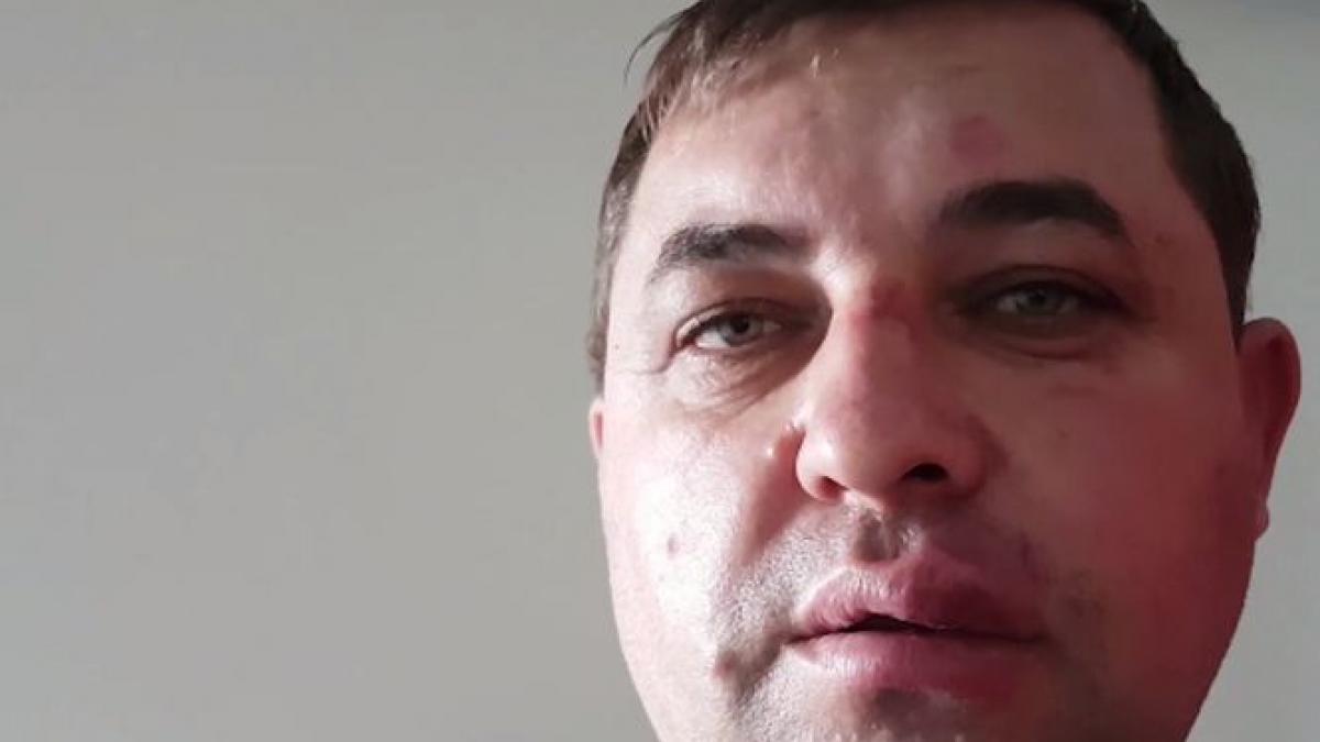 de ce a fost batut un viceprimar din romania