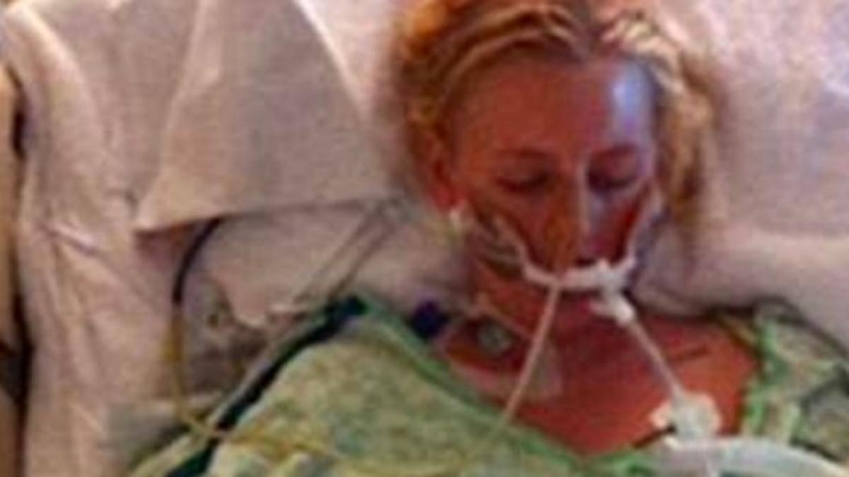 Și-a pierdut piciorul din cauza unui produs pentru igiena intimă. Acum îl va pierde și pe celălalt - IMAGINI ȘOCANTE