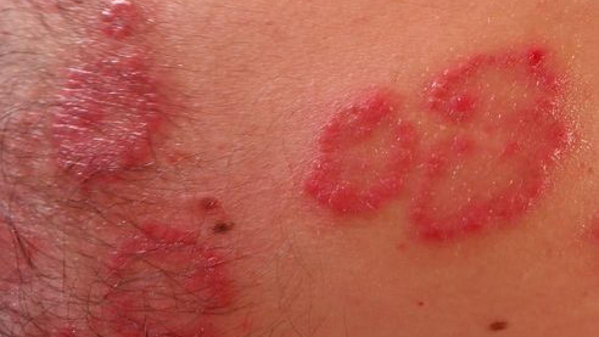 era la paris intr o excursie de vis cand a simtit o mancarime pe o coapsa a ignorat o dar iritatia