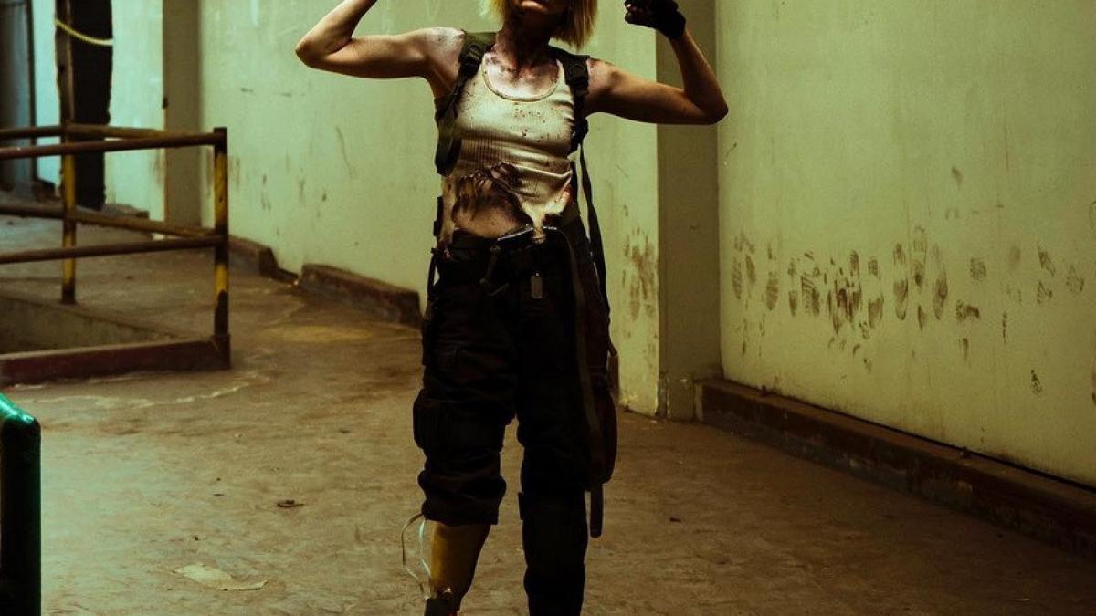 un celebru fotomodel va ramane si fara piciorul stang medicii i l au amputat deja pe dreptul ce a