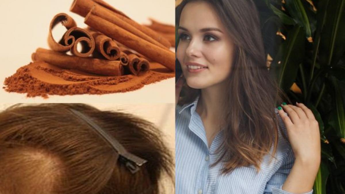 ii cadea parul si incercase tot felul de tratamente si a pus in fiecare saptamana scortisoara in