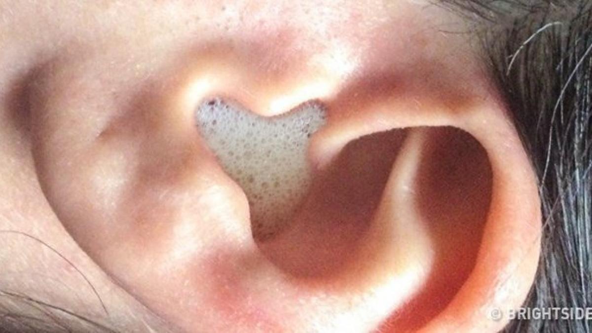 si a pus otet in ureche si a asteptat sa se evapore ce i s a intamplat apoi este genial