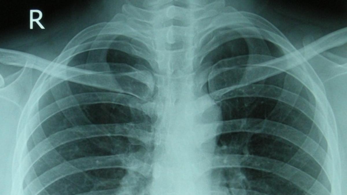 acestea sunt cele cinci obiceiuri zilnice care iti distrug oasele tu faci asta