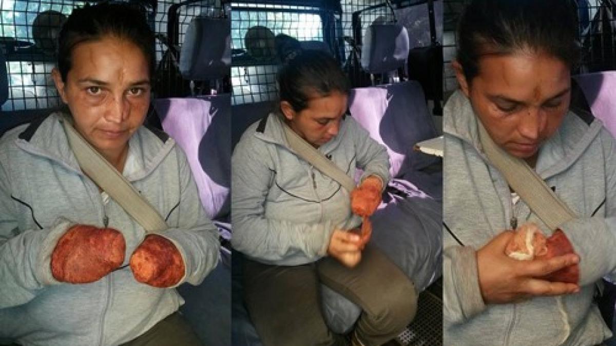 o cersetoare s a vindecat miraculos dupa ce a fost prinsa de jandarmi cand a auzit de amenda si a