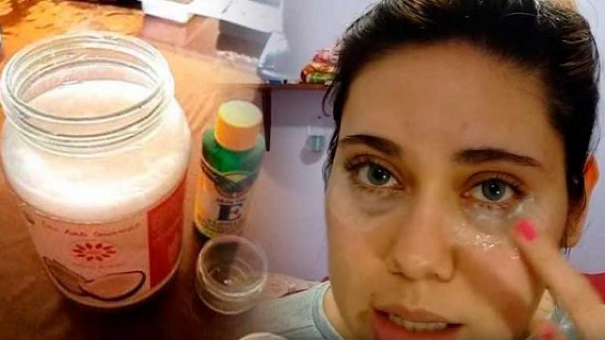 a amestecat trei ingrediente ieftine si si a sters cinci ani de pe chip cum se prepara crema