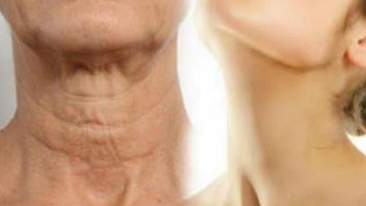 cum sa va intineriti pielea gatului printr o metoda foarte simpla