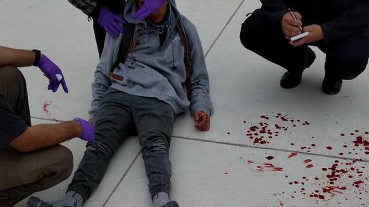 caz socant un copil cu sindromul adhd batut cu salbaticie de cativa colegi de clasa