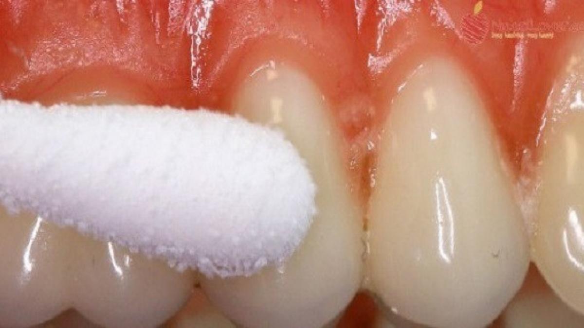 remedii rapide pentru durerile de dinti scapi de probleme in doar cateva minute