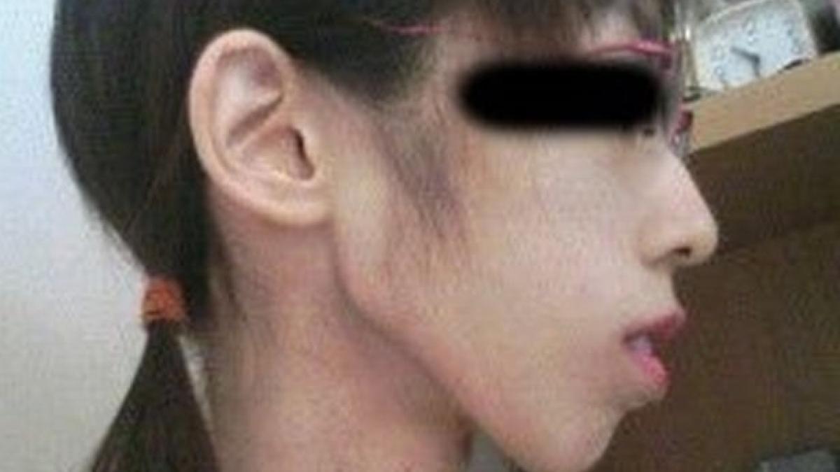 a fost batuta de familie daca indraznea sa manance cum a ajuns sa arate o tanara dupa ce a fost