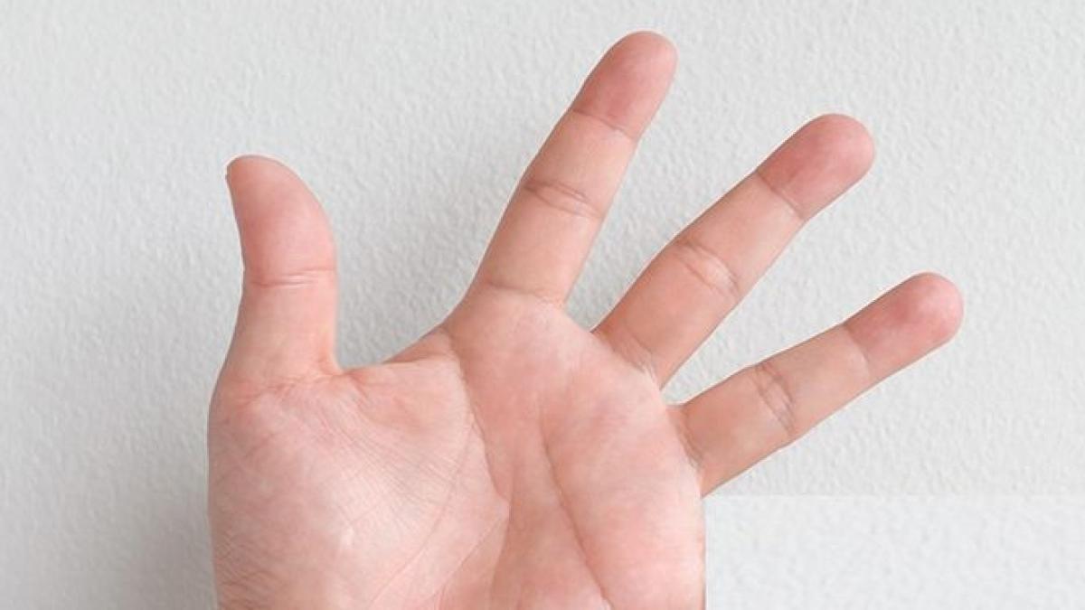 a iesit in oras cu prietenii si s a trezit in mod miraculos fara un deget tanarul habar nu are cum