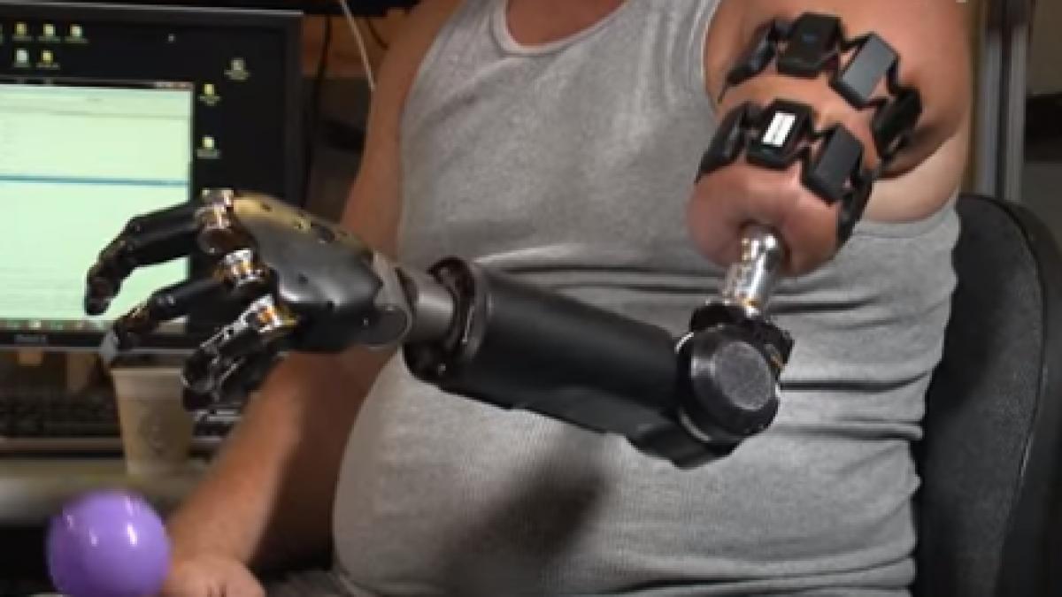 el este primul om care are un brat robotizat pe care il controleaza cu ajutorul creierului