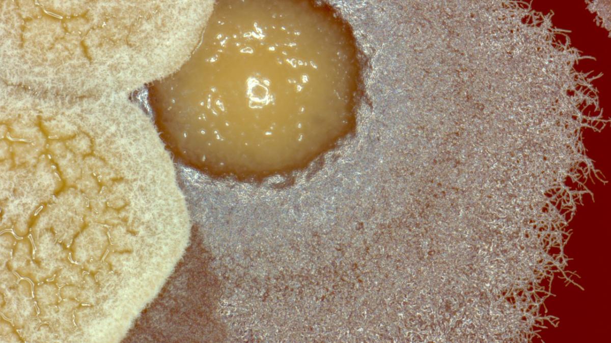 locul plin de bacterii pe care l credeai curat n ai cum sa l eviti