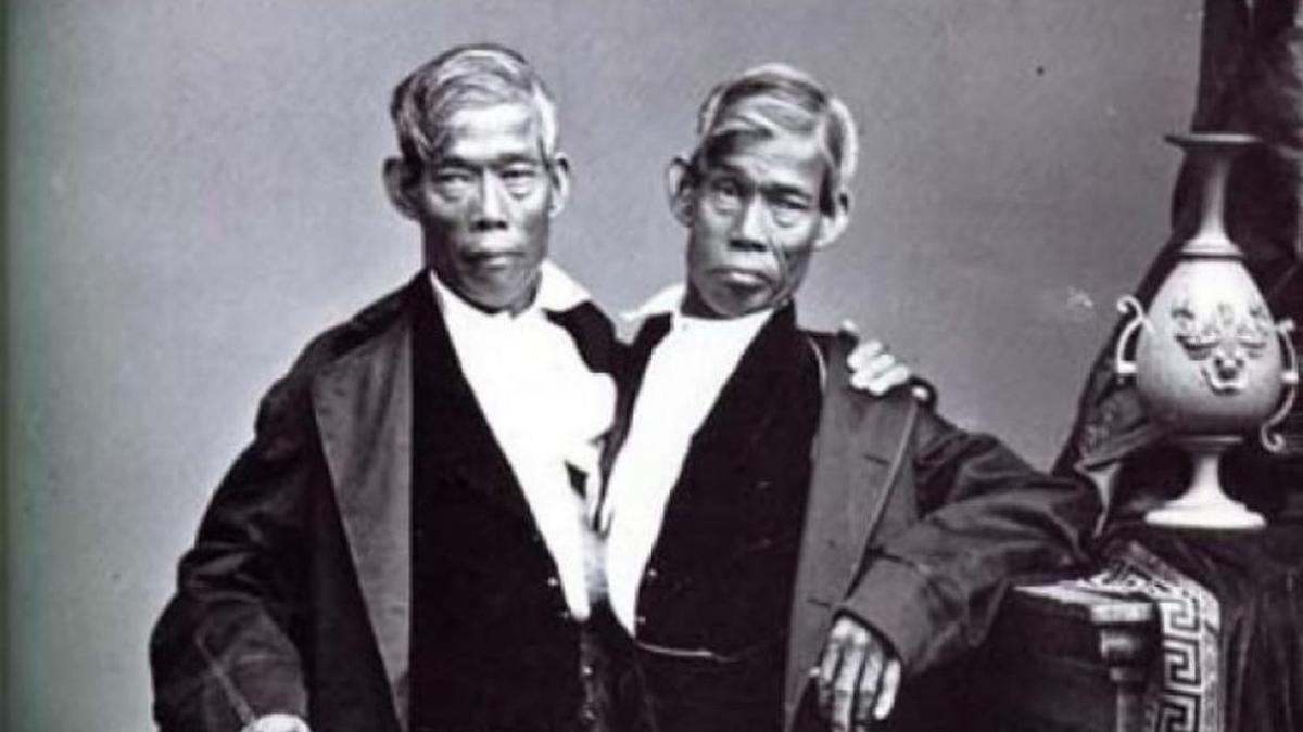 povestea controversata a primilor siamezi din lume cum s au insurat fratii bunker si au avut 21 de