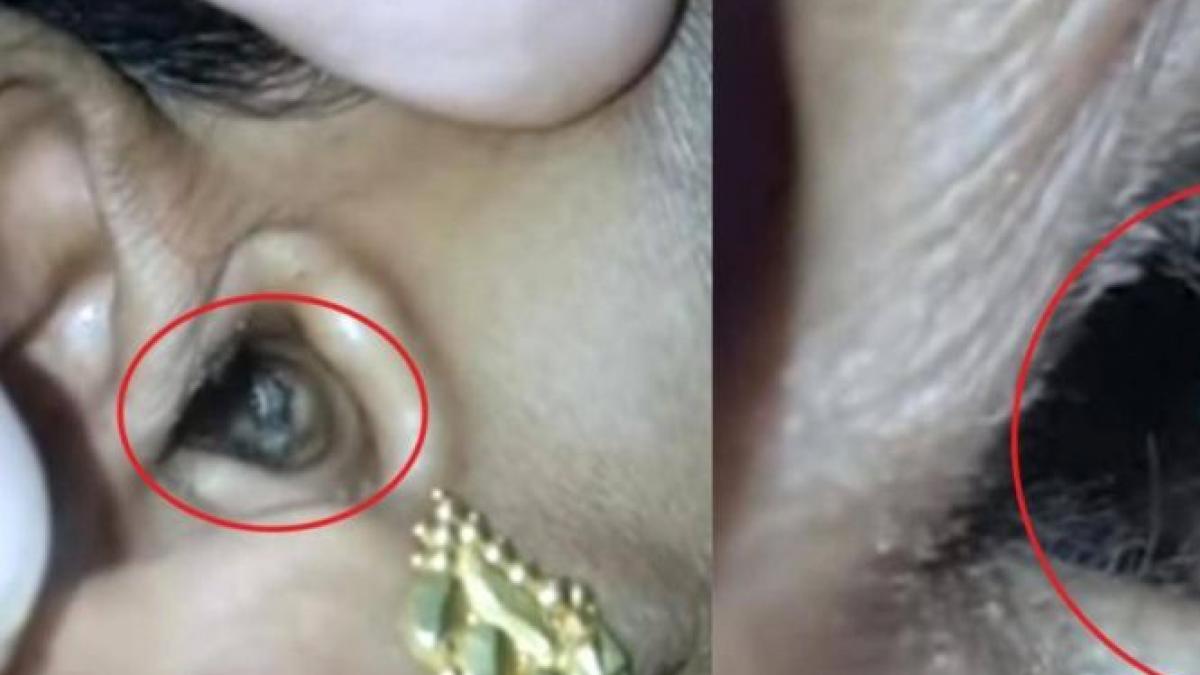 s a dus la doctor cu o durere puternica de cap medicii au fost socati cand au vazut ce are de fapt