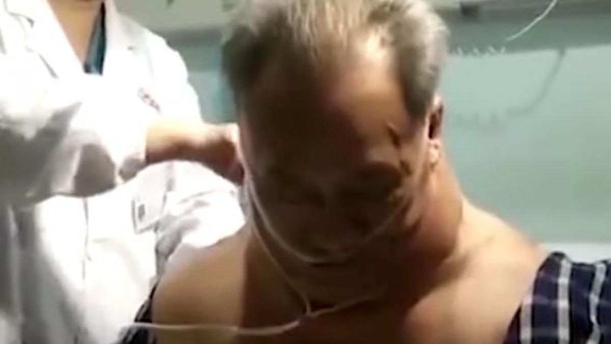 a consumat alcool in fiecare zi timp de 30 de ani cum arata astazi barbatul