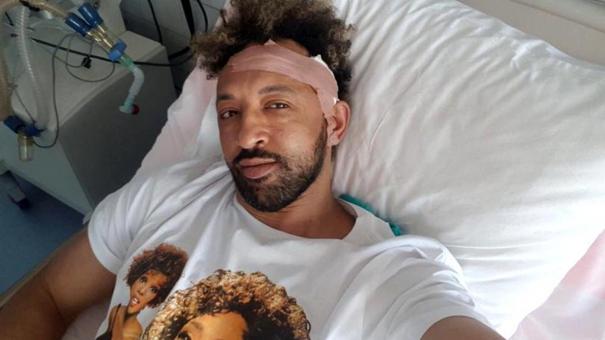 kamara a fost operat de urgenta dupa ce a suferit o fractura de pomete sinus si fisura de mandibula