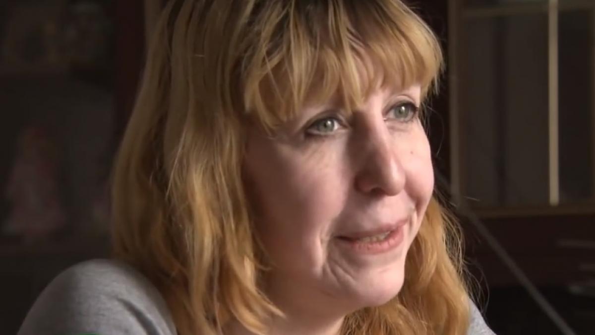 cum arata o tanara la numai 19 ani boala care o imbatraneste prematur video