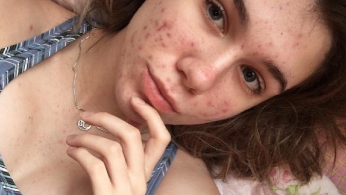 cand am fost admisa in spital mi s a spus ca mai am o zi pana sa orbesc