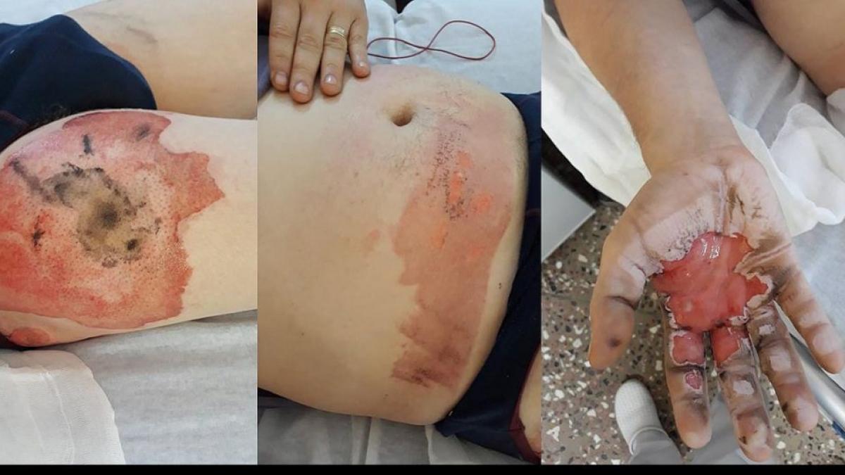 dragos si a bagat tigara electronica la incarcat la o baterie pe care o tinea in buzunar dupa