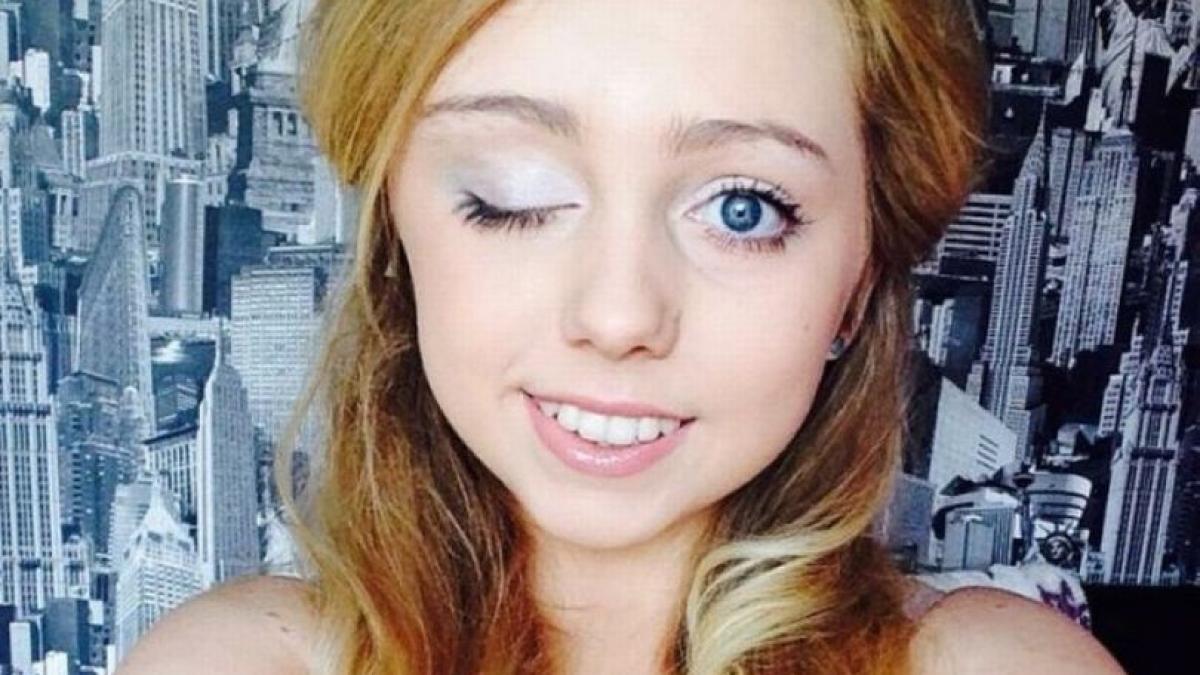 s a trezit intr o dimineata si a constatat cu groaza ca nu poate sa isi mai deschida ochiul drept a