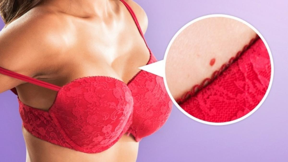 ce reprezinta aceste pete rosii de pe piele nimeni nu ti a spus asta pana acum