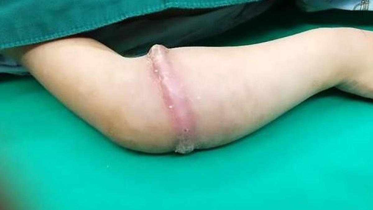 au observat o umflatura in jurul mainii fiicei lor cand au vazut o medicii au incremenit ce au