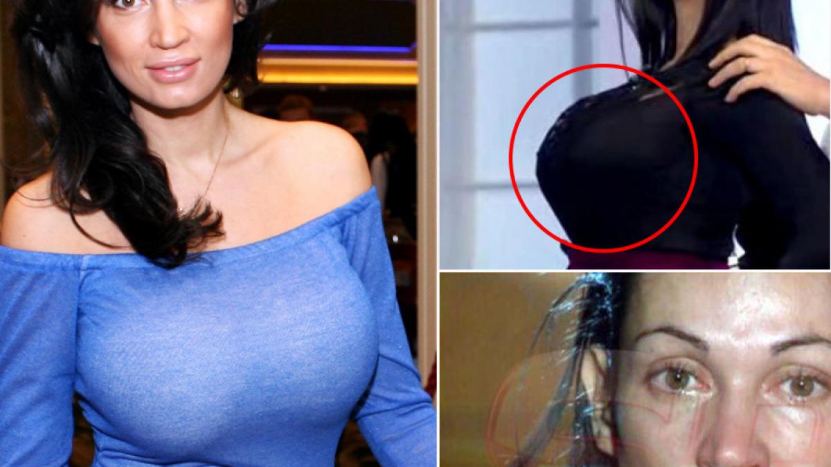 medicii i au spus de cancer si a decis sa si scoata de urgenta silicoanele veste cumplita pentru