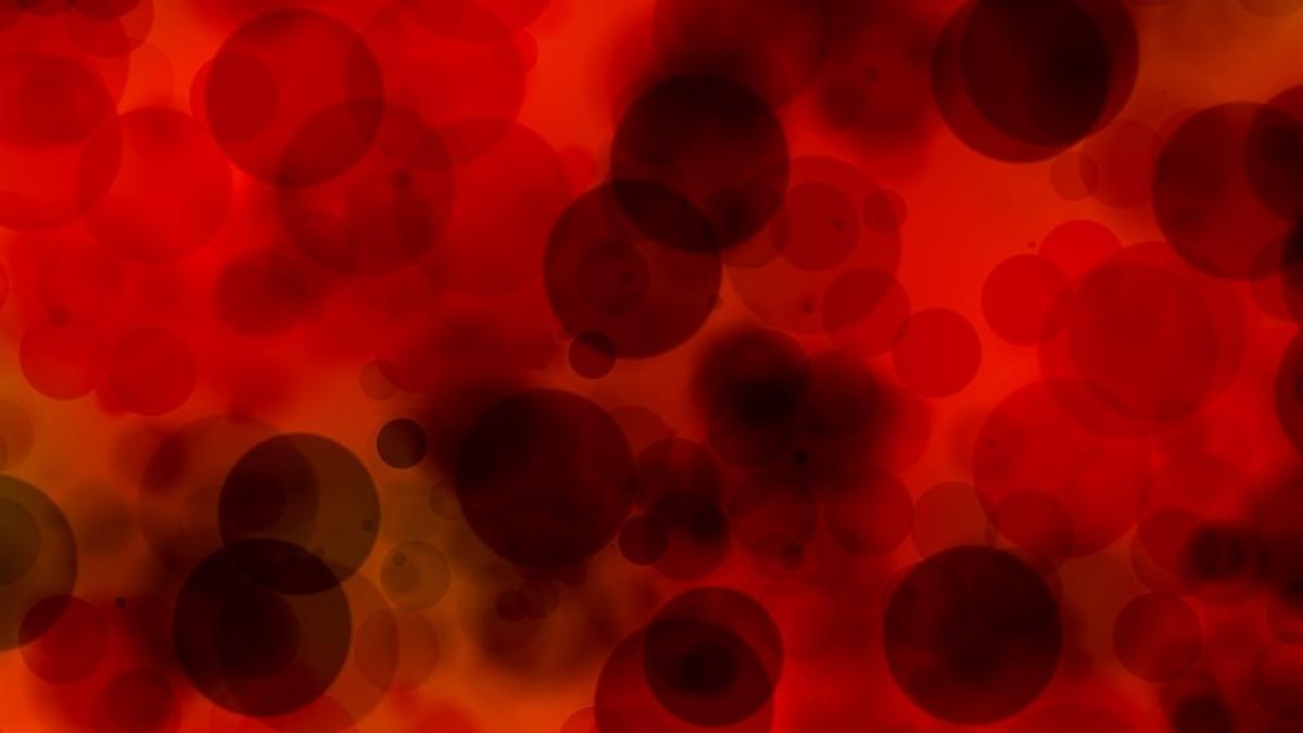 atentie semnele care indica faptul ca ai cheaguri de sange