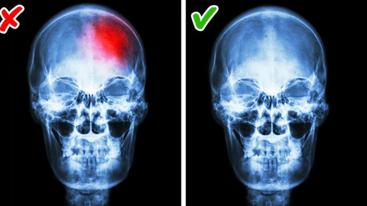 adormi dupa mai mult de 30 de minute de stat in pat poti avea o boala grava daca ai insomnii
