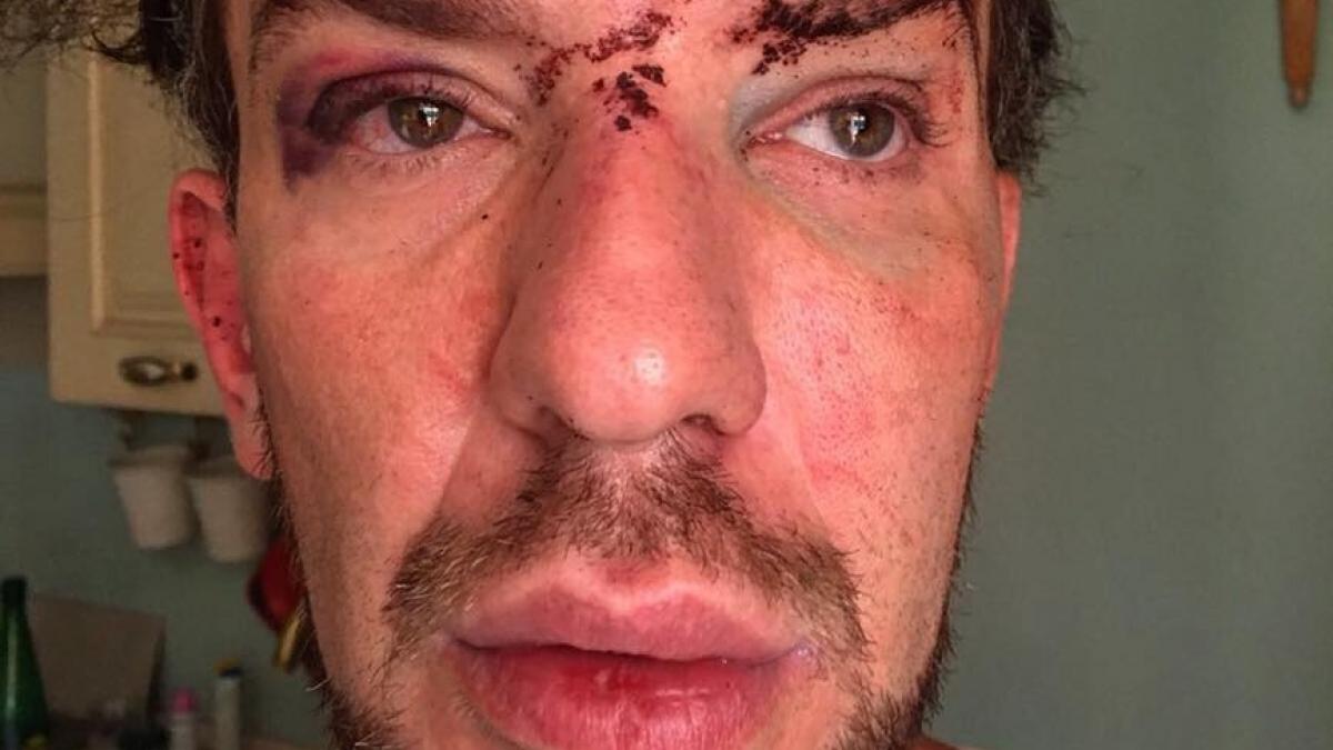 creatorul de moda roman stephan pelger a fost agresat si jefuit la cannes